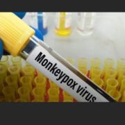 Monkeypox: Health Minister Stresses Need For Increased Vigilance – St. Lucia Times News