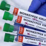 Health Ministry confirms first case of Monkeypox in Barbados