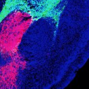 Científicos descubren la molécula que da origen al miedo en el cerebro