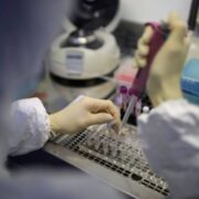175 new covid19 cases, no deaths