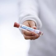 Salud reporta 9 muertes y 294 hospitalizaciones por COVID-19