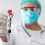 Only 3,500 doses of monkeypox vaccine made available to Ja – Tufton Loop Jamaica